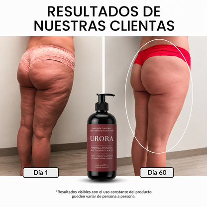 Urora Crema Anticelulitis y Reafirmante