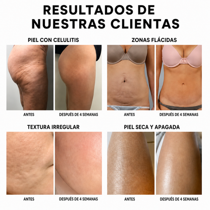 Urora Crema Anticelulitis y Reafirmante