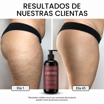 Urora Crema Anticelulitis y Reafirmante